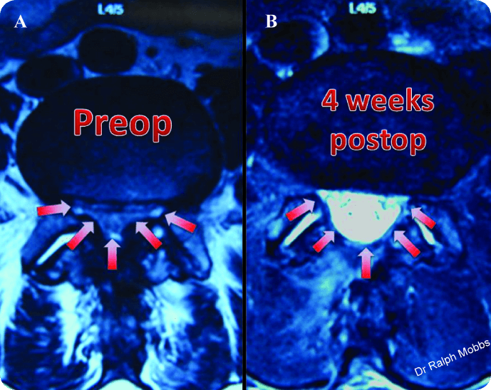 Figure 1 ready